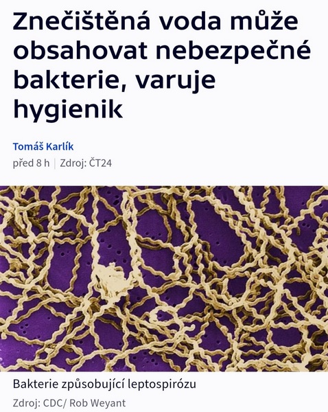 Bakterie způsobující leptospirózu Zdroj: CDC/ Rob Weyant